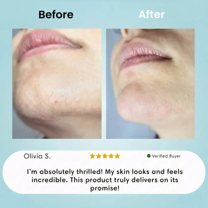 Facial Hair Removal Cream